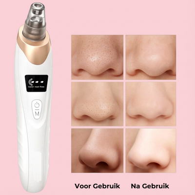 Mivona™ | Pore Perfect