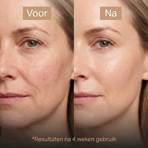 Mivona™ | Anti-Aging Crème