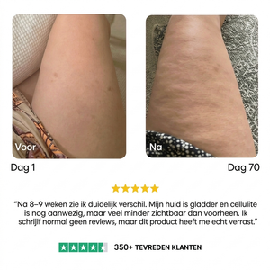 Mivona™ | Cellulite Smooth Pro