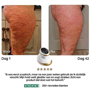 Mivona™ | Cellulite Smooth Pro