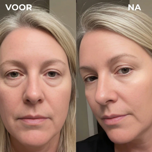 Mivona™ | Glow Eye Pads