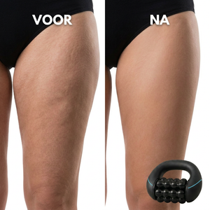 Mivona™ | Sculpting Device