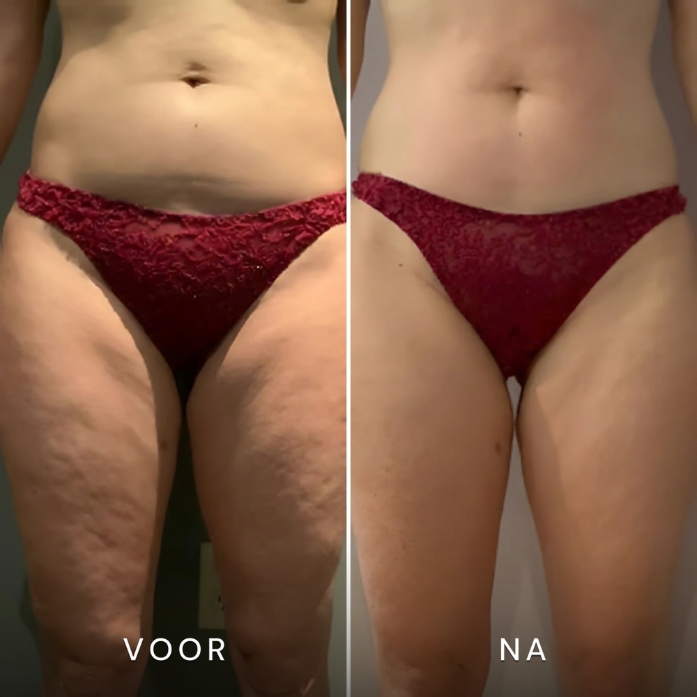 Anouk J. · 36